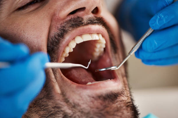 Emergency Dentist for Dental Implants