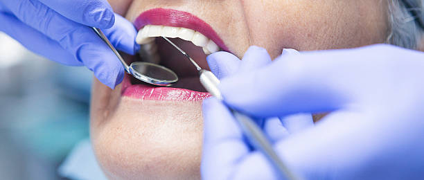 Best Mobile Emergency Dentist in Mather, CA